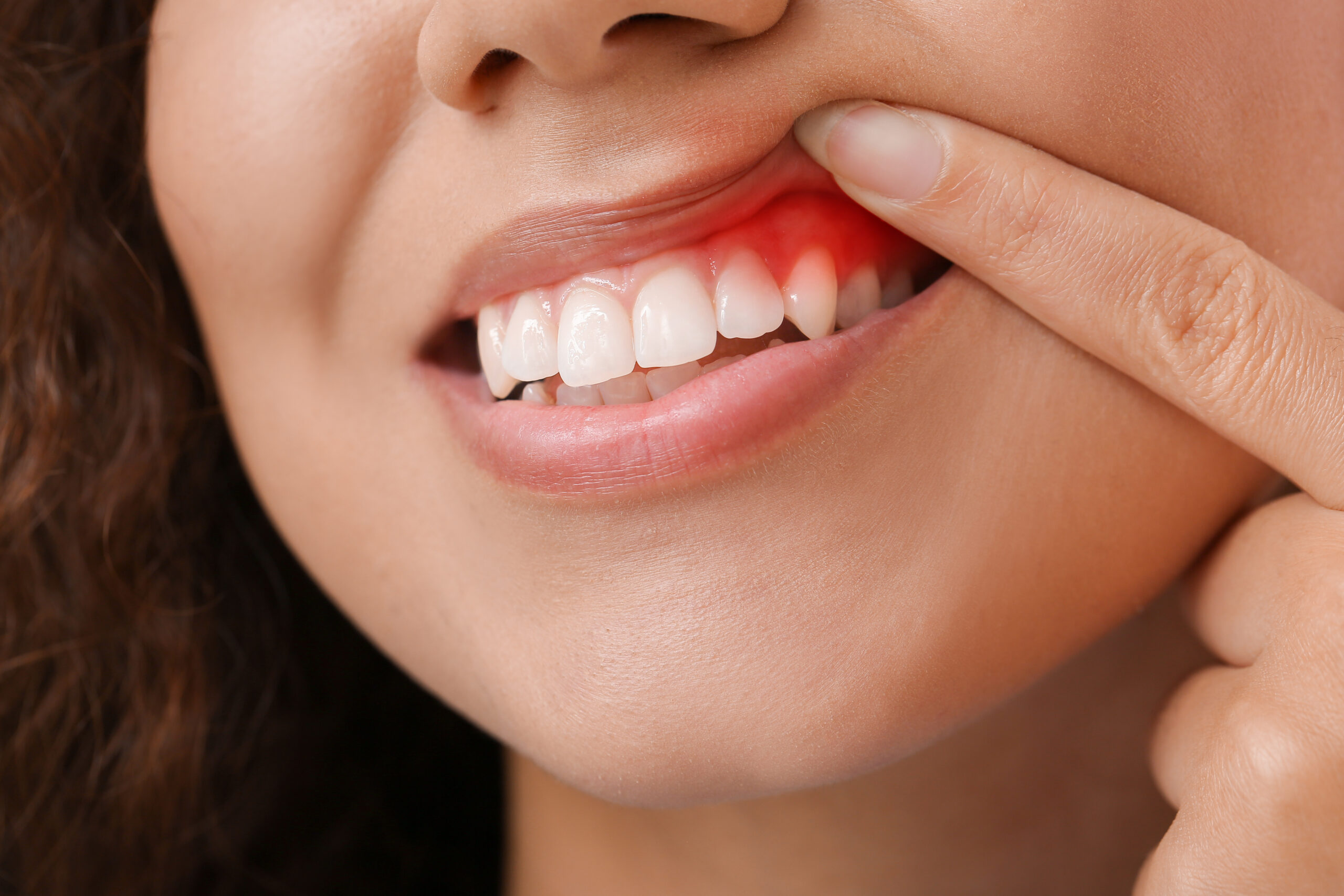 Understanding Periodontics: Why Your Gums Matter More Than You Think